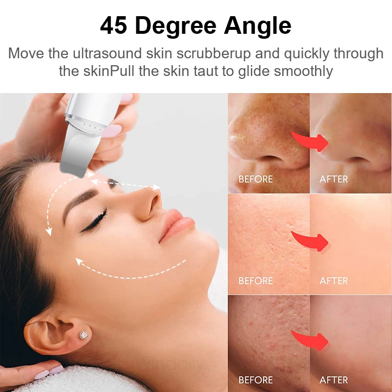 Ultrasonic Skin Scrubber Vibration Face Spatula Blackhead Remover Shovel Clean Cavitation Peeling Facial Lifting Skin Care Tools 6