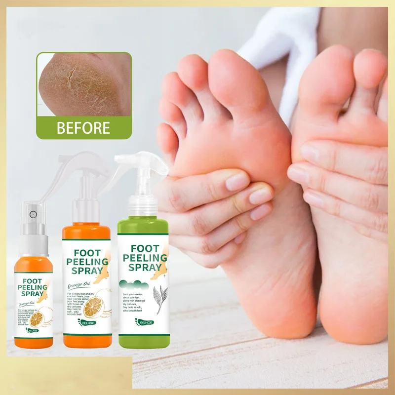 

Japan Cosmetics Foot Peeling Spray Exfoliator Natural Orange Essence Pedicure Hands Dead Skin Mask Whiten Baby Foot Care Tool