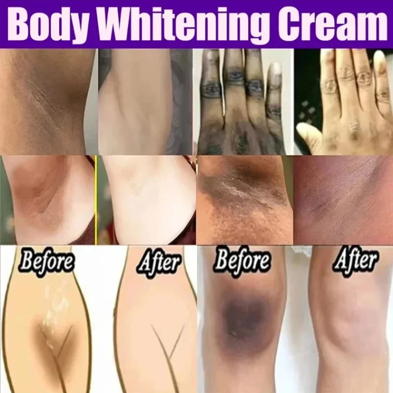 Whitening Cream Private Parts Underarm Bleaching Whiten Butt Knee Brighten Inner Thigh Intimate Parts Dark Remove Melanin Care 4