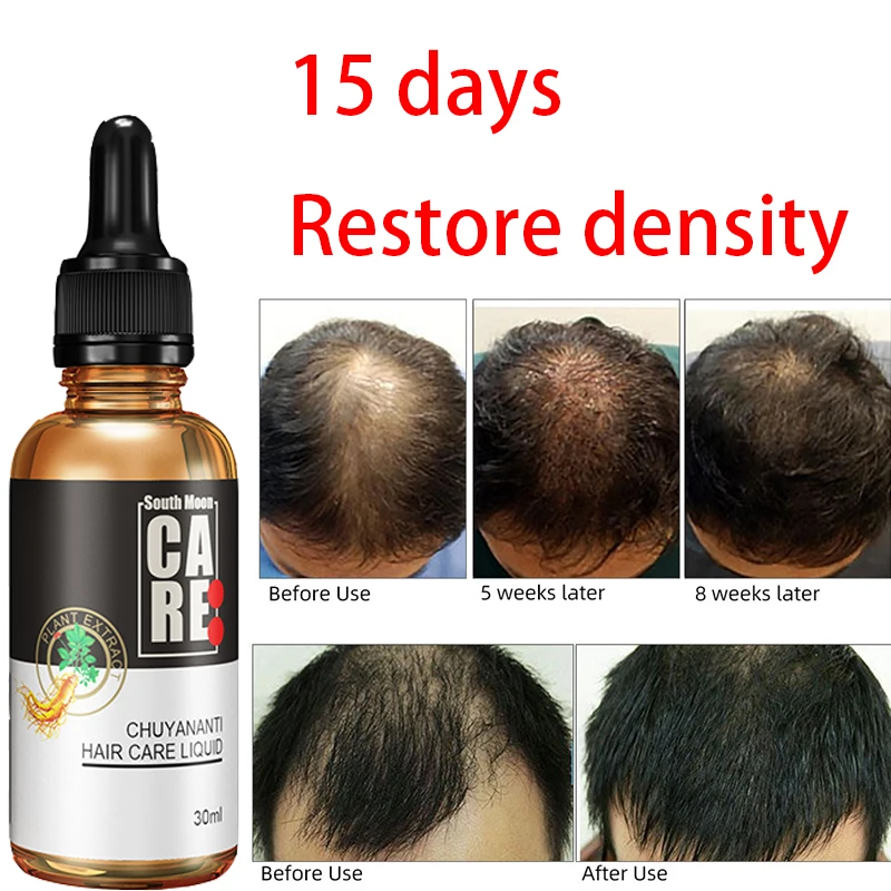 

Anti hair loss and development hair liquid, hair growth and enhancement hair care line, hair growth and hair growth liquid