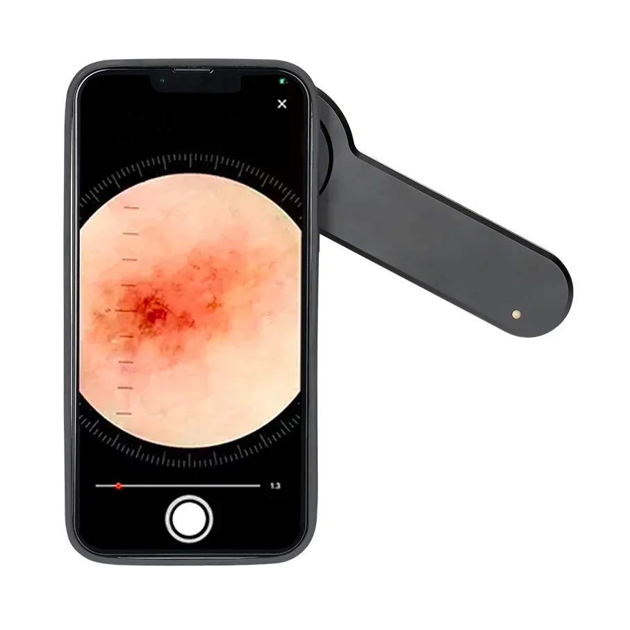 XMSJ Hospital Medical Microscope DE-3100 PRO Polarized UV Dermatoscope
