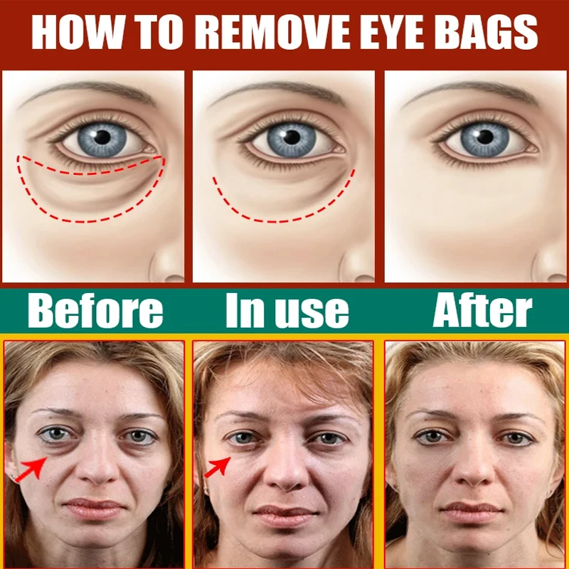Eyes Bag Remove Collagen Eye Patch Instant Fade Fine Lines Dark Circles Fat Particles Moisturizing Anti-Puffiness Korea Eye Care collagen eye mask eye mask patch