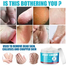 

Chinese Herbs Crack Foot Cream Foot Care Anti-Drying Heel Cracked Repair Oil Cream Removal Dead Skin Feet Hand Care Tools 30/50g