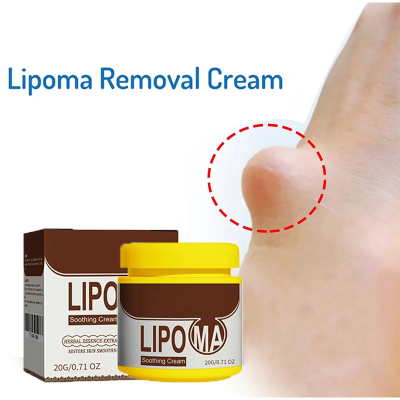 Treatment Lipoma Cream Subcutaneous Lumps Remover Medicine Liquid Apply To Skin Swelling Cellulite Fibroma Fat Mass Plaster