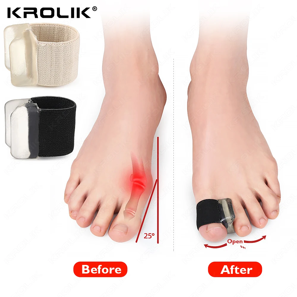 

2Pcs Silicone Toes Separator Bone Ectropion Adjuster Toes Outer Appliance Big Hallux Valgus Corrector Foot Care Tool Elastic Ban