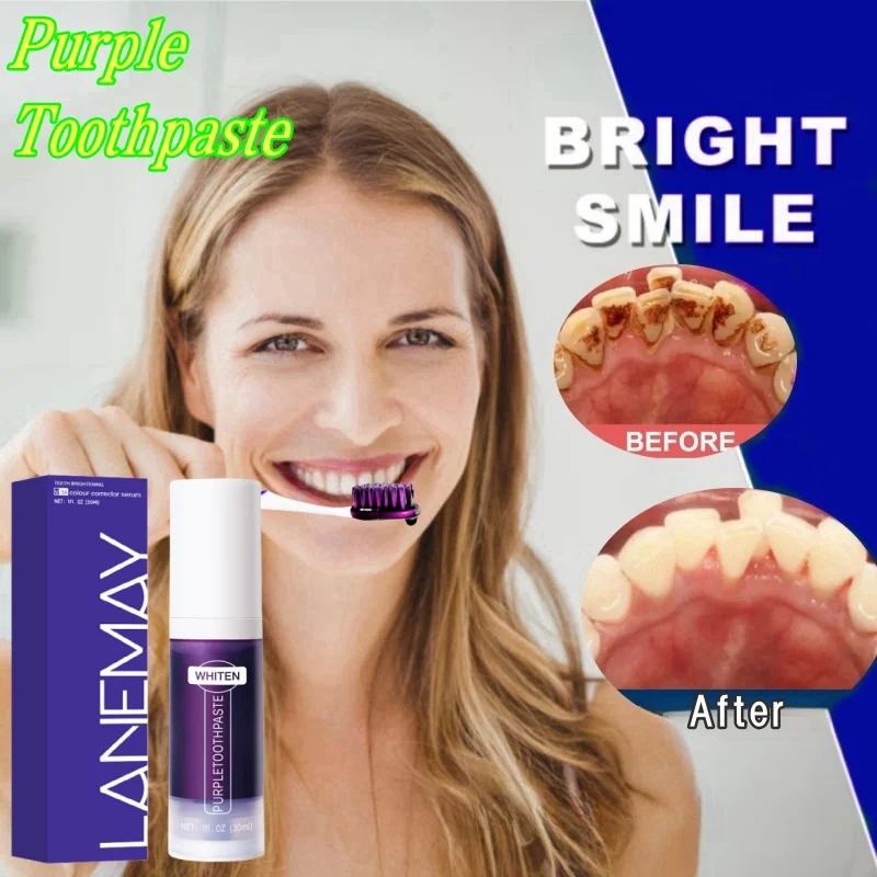 

V34 Teeth Whitening Toothpaste Serum Remove Plaque Stains Oral Hygiene Cleaning Dental Bleaching Tools Fresh Breath Tooth Care