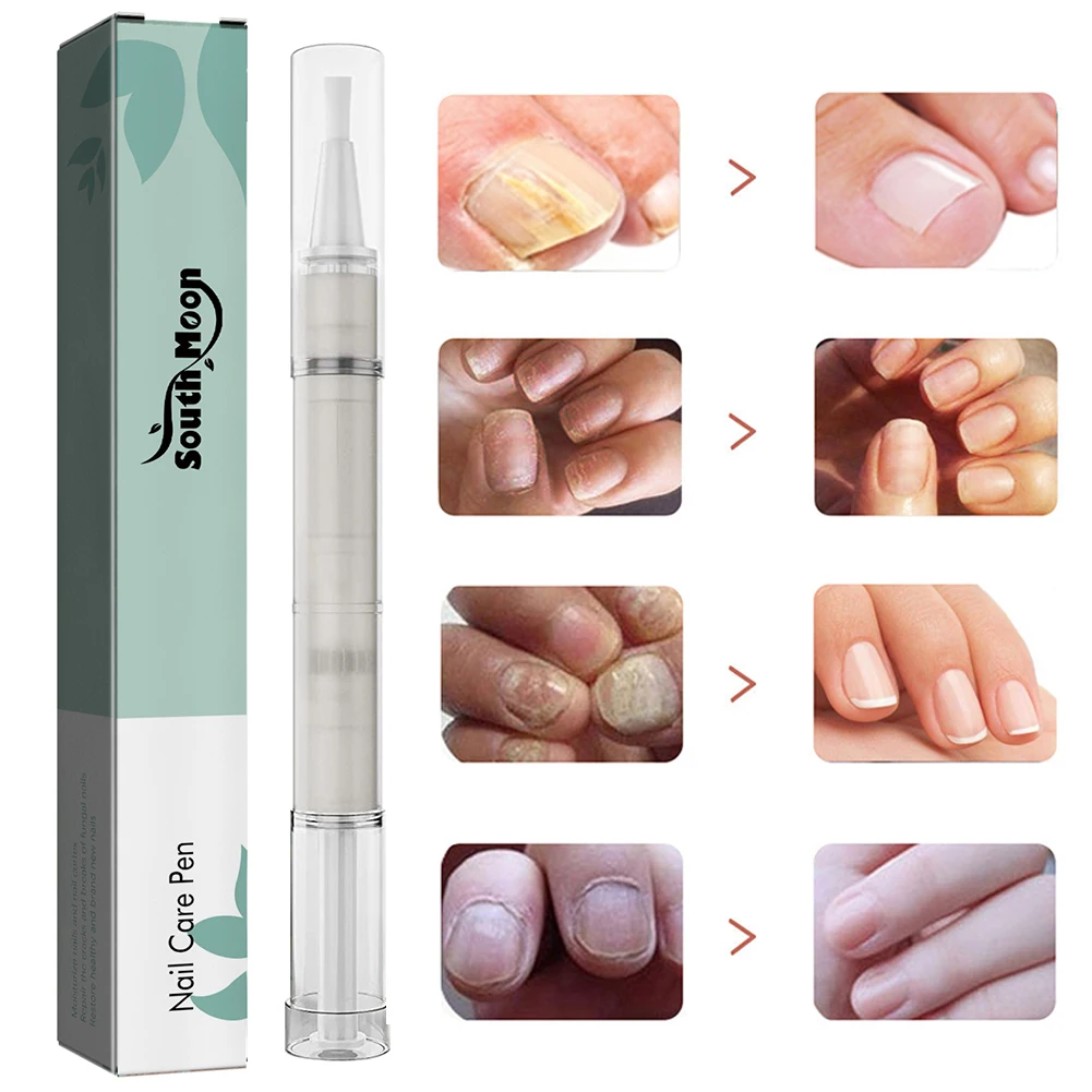 Nail Care Pen 4ml Toenail Repair Pen with Natural Ingredients Cuticle Oils Moisturizing for Restoring Healthy Strong Nails nail care oil nail strengthener nail cuticle oil pen