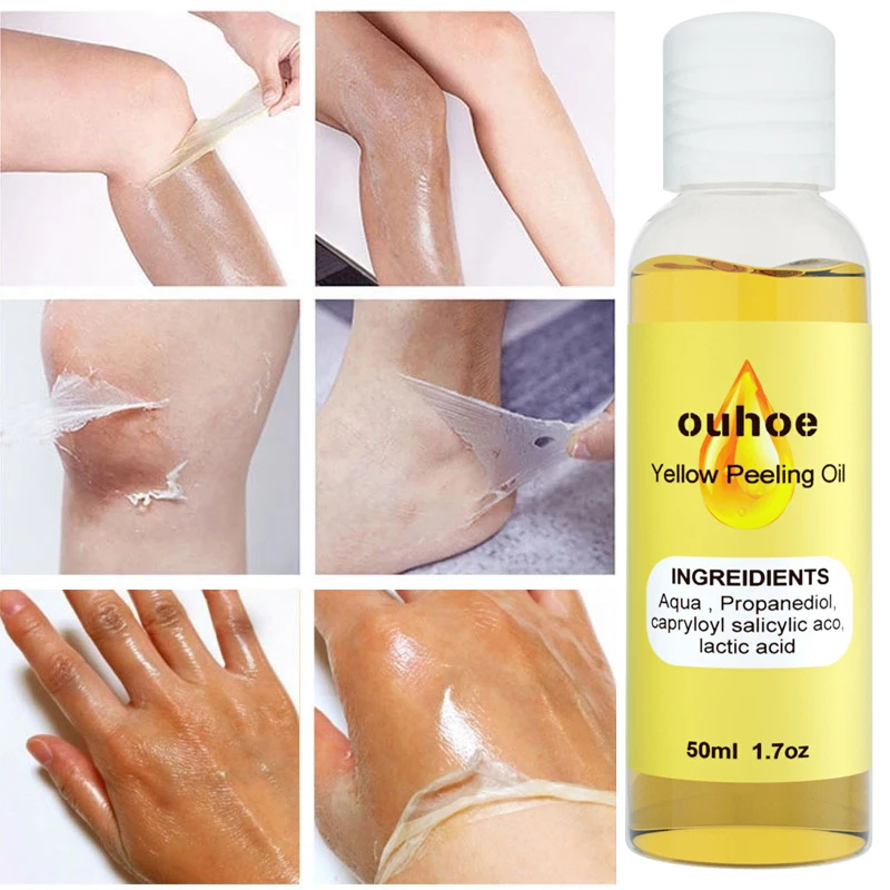 

Yellow Peeling Oil Dark Skin Bleaching Remove Arm Knee Legs Melanin Body Lightening Scrub Exfoliating Dead Skin Whitening Serum