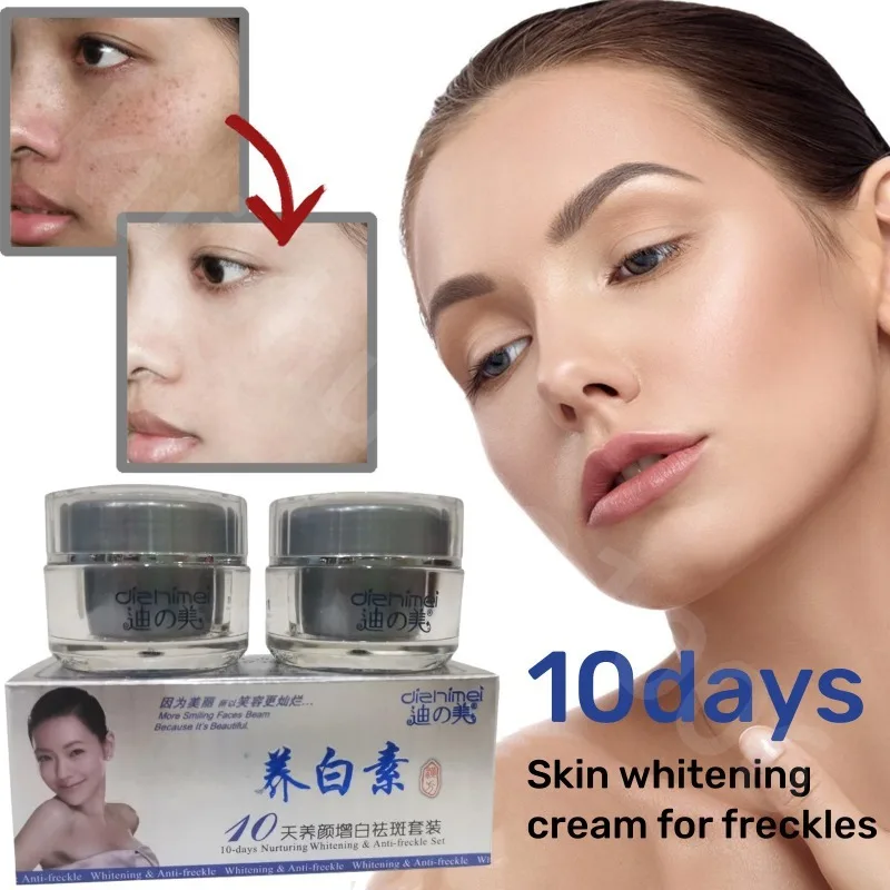 Anti-Pigment Face Whitening Cream Powerful Effects Whitening Anti Freckle Melasma Bleaching Remove Dark Spots Skin Care Products bleaching cream for dark skin intense top quality bleaching whitening cream for face neck hands and feet without side effects