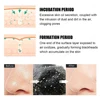 Unisex Deep Cleansing Nose Strips for Acne & Blackhead Removal Shrink Pore Nose Black Head Stickers Skin Care Patch 3