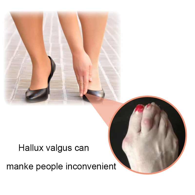 2Pcs=1Pair Protect Toe Separator Bunion Hallux Valgus Corrector Thumb Correction Material Soft Straightener Foot Care Tool H066