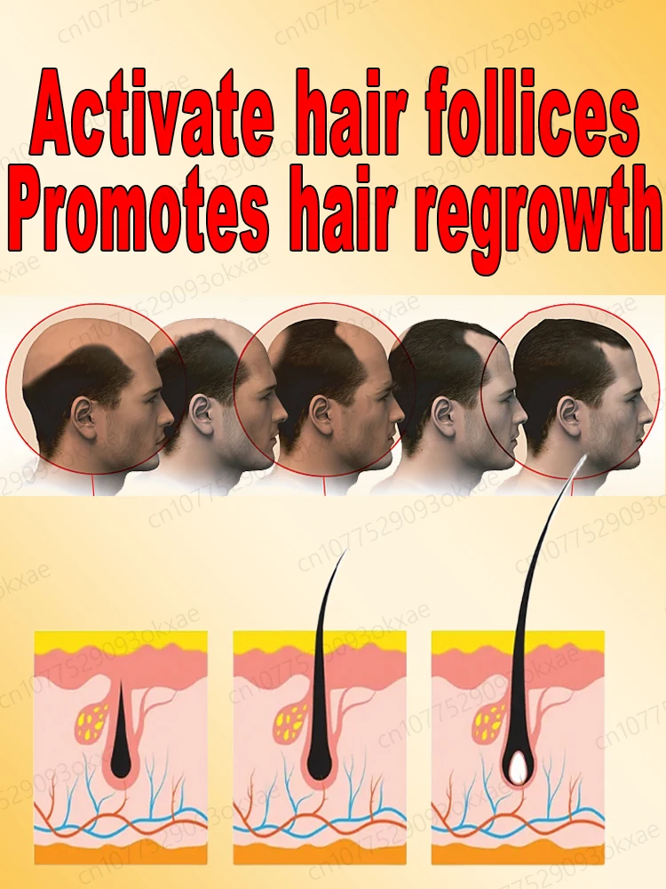 Hair Growth Serum Hair growth product solves hair loss and baldness problem makes hair grow longer