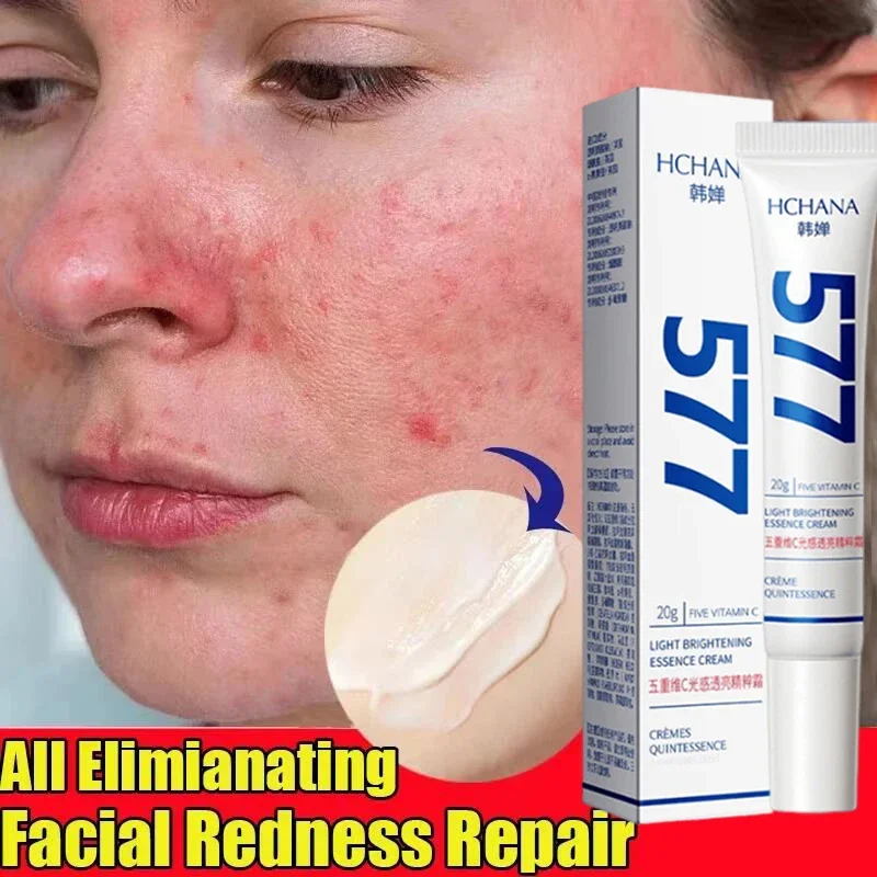 إصلاح احمرار الوجه كريم لحظة العنكبوت الوريد إزالة الجلد الحساسة تهدئة مكافحة احمرار Rosacea علاج غسول مستحضرات التجميل الكورية