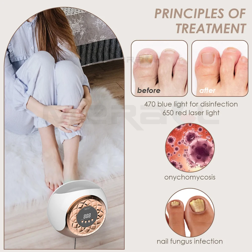 Nail Fungus Laser Device Painless Anti Onychomycosis Toenail Fungal Cleaning Machine Finger Nail Care Toenail Fungal Treatment