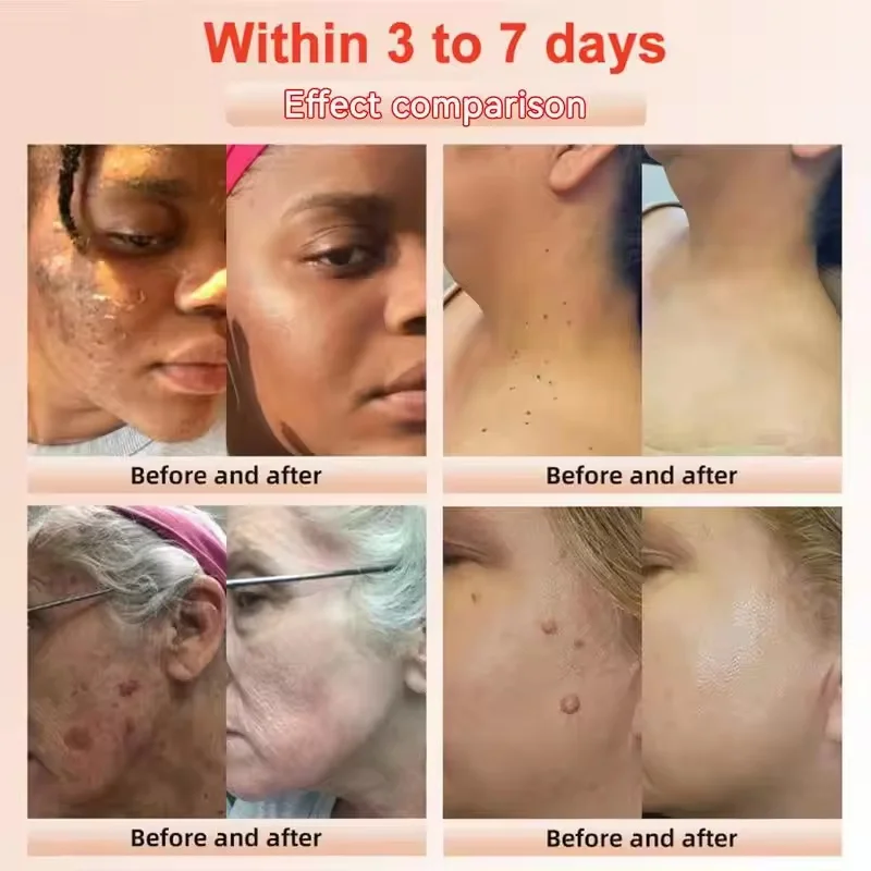 Revitalize Skin Fruit Acid Peeling Gel Facial Cleansing Exfoliating Peeling Scrub Deep Clean Acne Blackhead Remove Face Cleanser facial cleanser