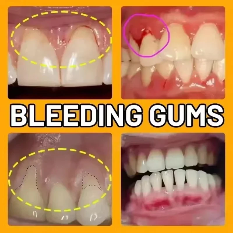 Gum Repair Drops Tooth Decay Repair Rapid Repair Gums Serum for Tooth Allergy