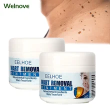 

30g Skin Tag Remover Cream Warts Mole Remove Medical Ointment Antibacterial Foot Corn Chinese Medicine Herbal Beauty Health Care