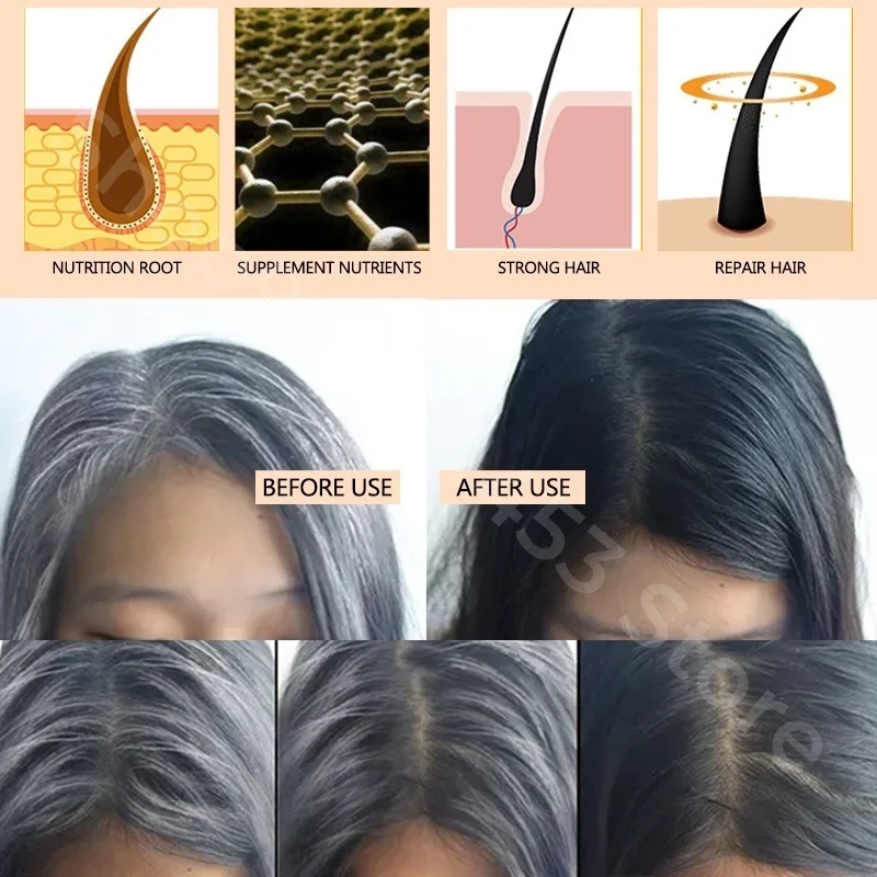 Black Ganoderma and Polygonum Multiflorum Plant Shampoo Repairs and Nourishes Damaged White Hair and Turns It Into Black Hair 4