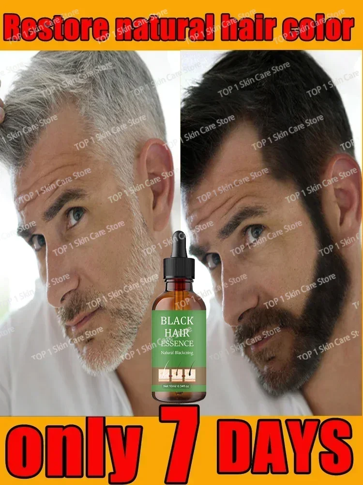 White hair killer, remove gray hair and restore natural color in 7 days