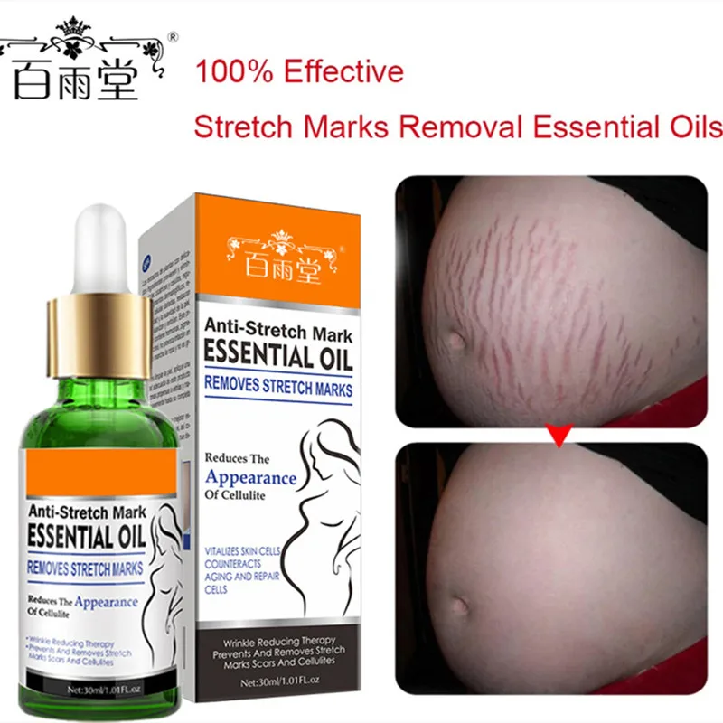 Stretch Marks Remover Essential Oil Skin Care Treatment Cream For Stretch Mark Removal Maternity Slackline For Pregnant Oils