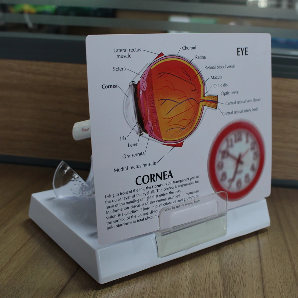 Cornea Eyeball Model Human Eye Demonstration Glaucoma Cataract Anatomy Medical Teaching Tool