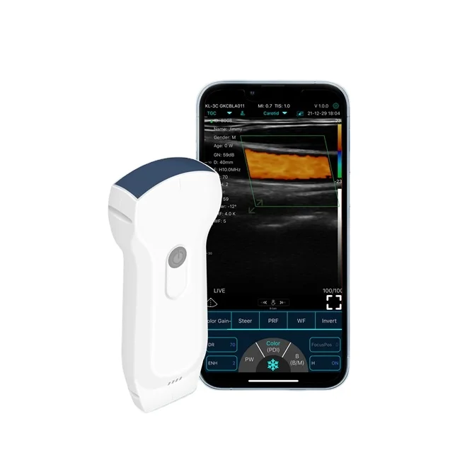 

Portable Wifi Usb Linear Double Probes Konted Wireless Handheld Ultrasound Scanner Doppler Ultrasound Probe