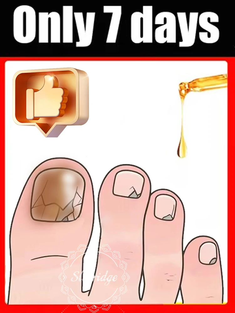 2025 Toenail Fungus Patch Waterproof Nail Repair Patches Ingrown Correction Sticker Discolored Damaged Foot Care Tool