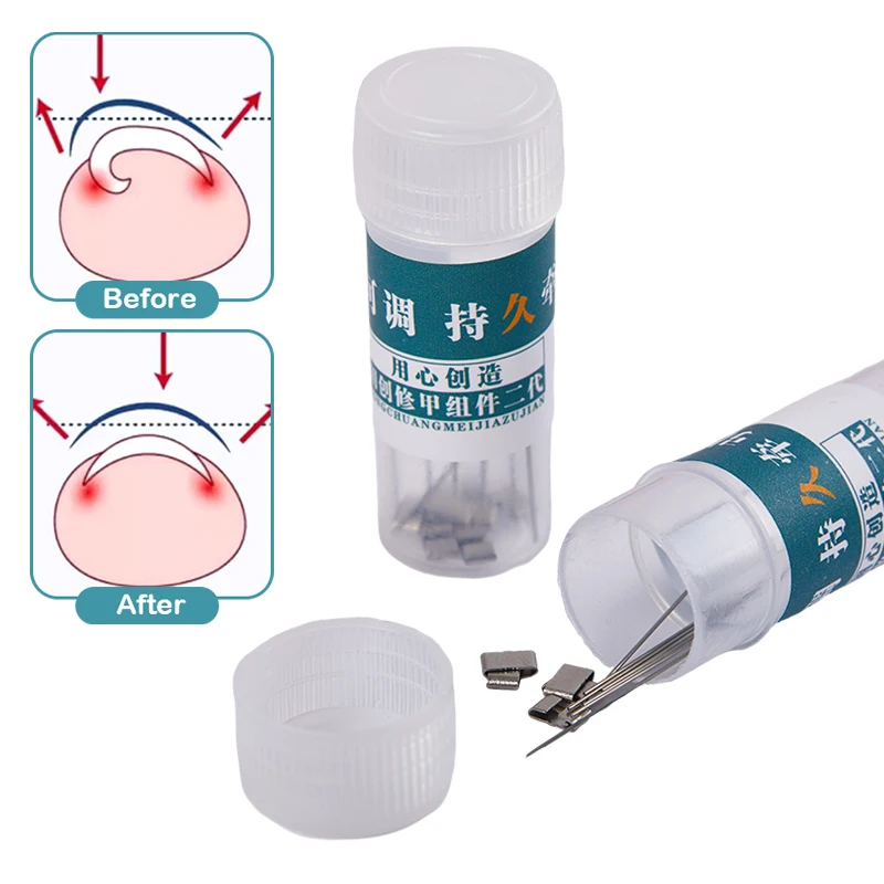 Ingrown Toenail Correction Tool Ingrown Toenail Corrector Tools Pedicure Recover Embed Toe Nail Treatment Professional Straightening Clip Brace