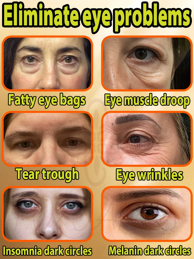Lifting eye cream unlock eye firmness and regain youthful confidence