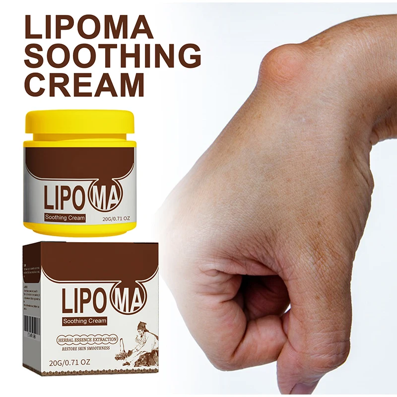 Soothing Cream Subcutaneous Lumps Remover 20g cream lumps remover
