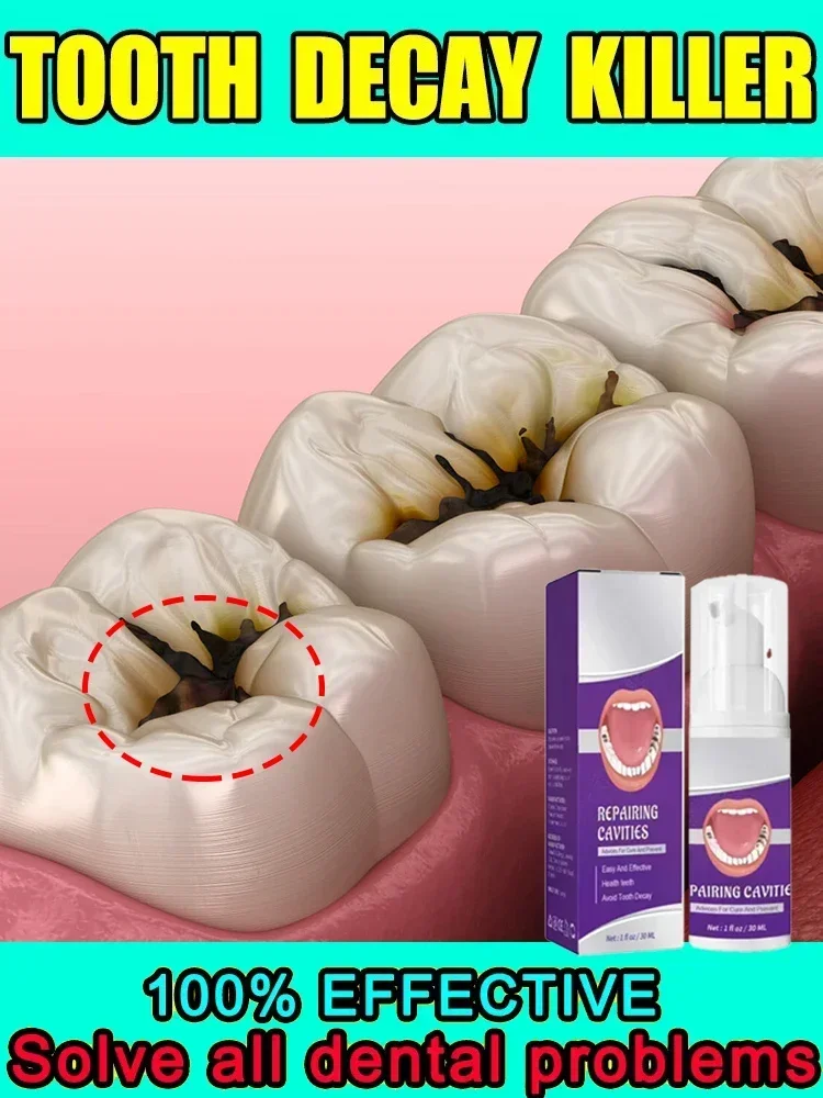 Tooth Decay Repair Tooth decay repair all tooth decay cavities and protect teeth Colour Correcting