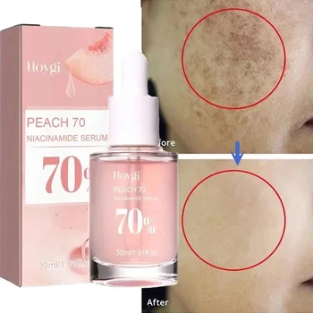 Niacinamide Dark Spots Remover Facial Serum Whitening Freckles Essence Fade Melanin Acne Corrector Anti-Aging Brighten Skin Care