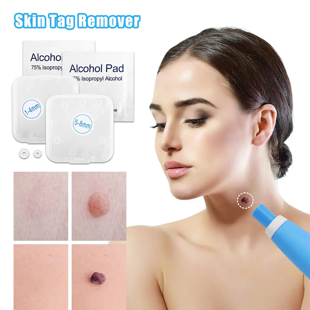2 In1 Skin Tag Mole Wart Removal Kit Cleaning Tools Skin Care Wart Treatments Remover
