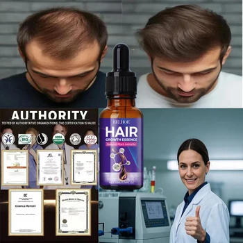 Hot sale, buyers will buy again, hair is getting more and more, say goodbye to baldness, sparse hair starts to become thick.