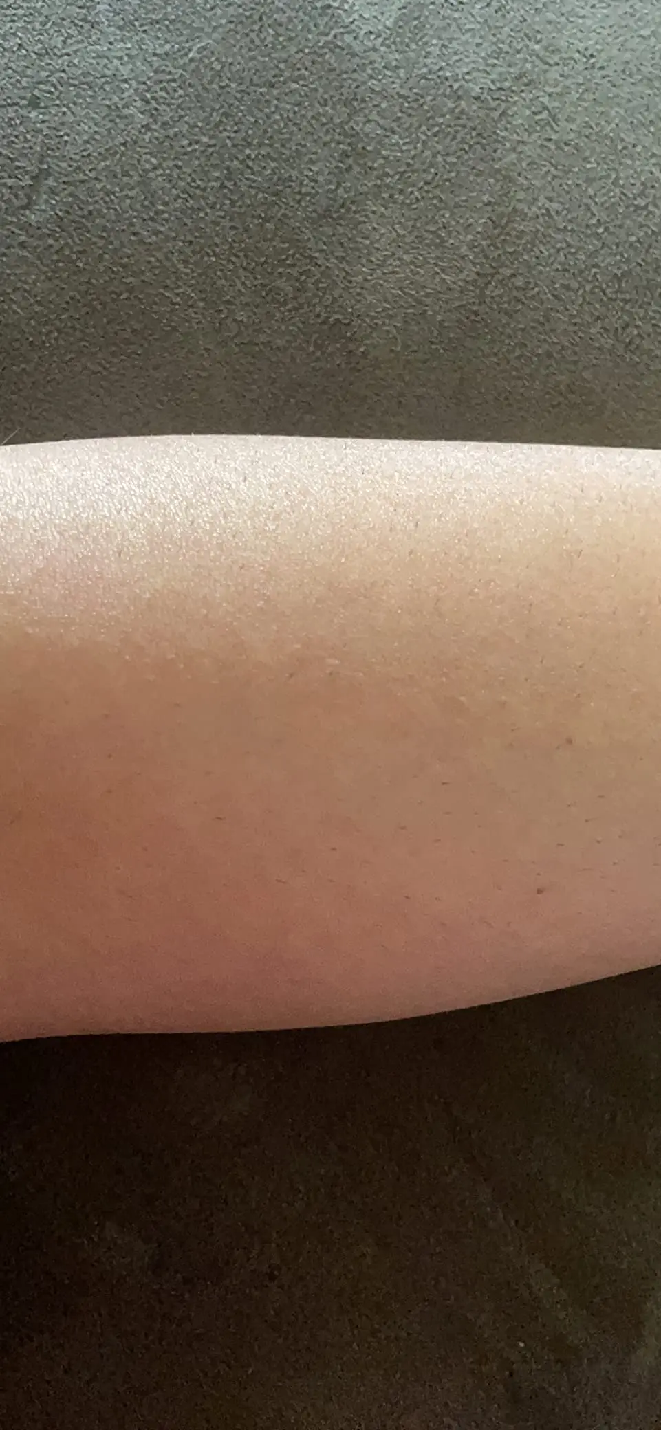 Premium IPL Laser Hair Removal Device 2.0™ photo review