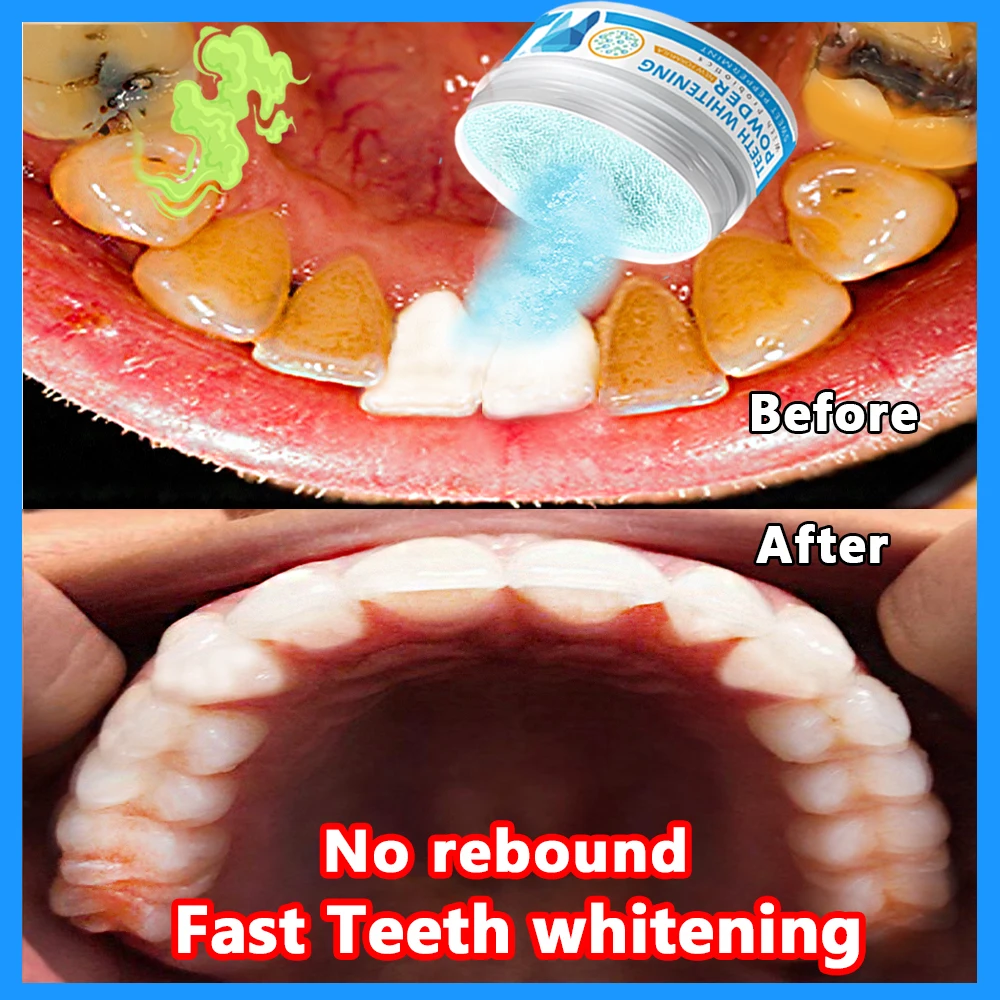 ProbiotiTeethWhiteningPowderTeethStainRemoverToothBrightening