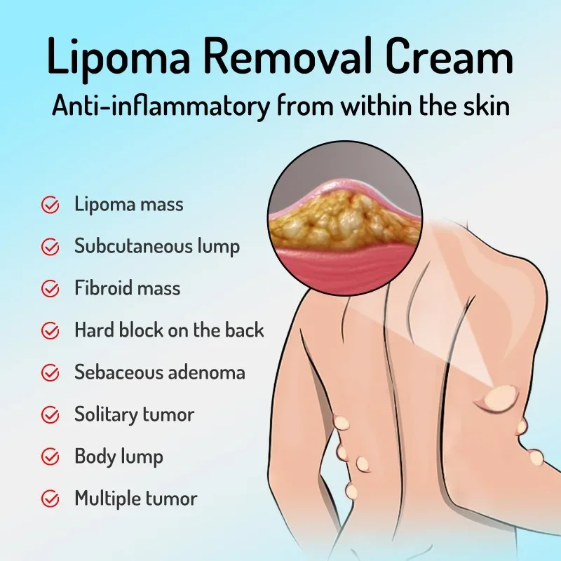 Рисунок 4 - Крем Lipoma для удаления жира и целлюлита