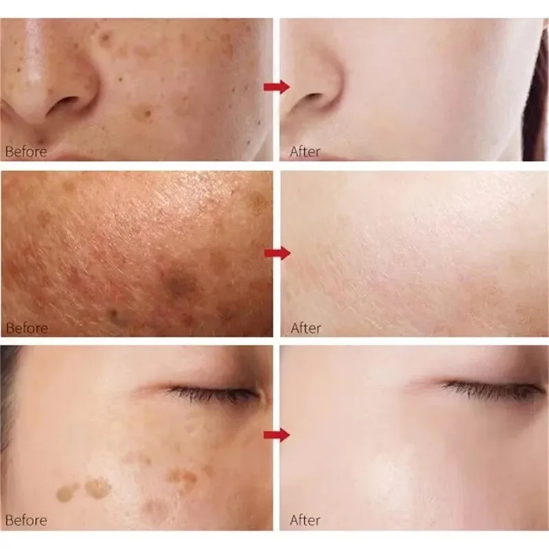 30ml Peach 70% Niacinamide Serum Moisturizing Prevent Dryness Facial Essential Oil Increasing Elasticity Smooth Soften Skin Care 4