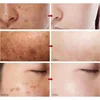 30ml Peach 70% Niacinamide Serum Moisturizing Prevent Dryness Facial Essential Oil Increasing Elasticity Smooth Soften Skin Care 4