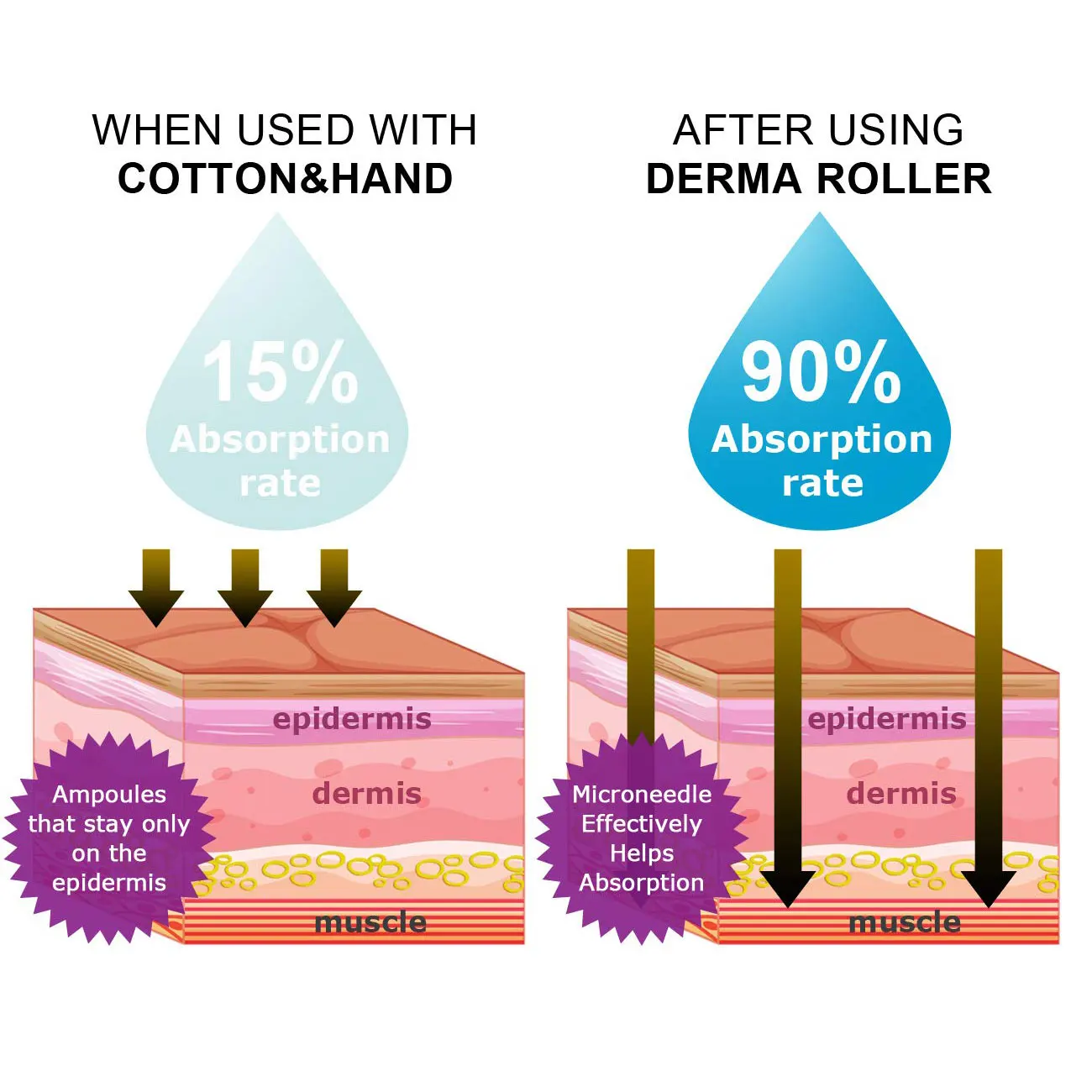 DRS540 Derma Face Roller 540 Pins Medical Grade Microneedling Dermaroller Beauty Skincare Tool with CE and RoHs Certificate