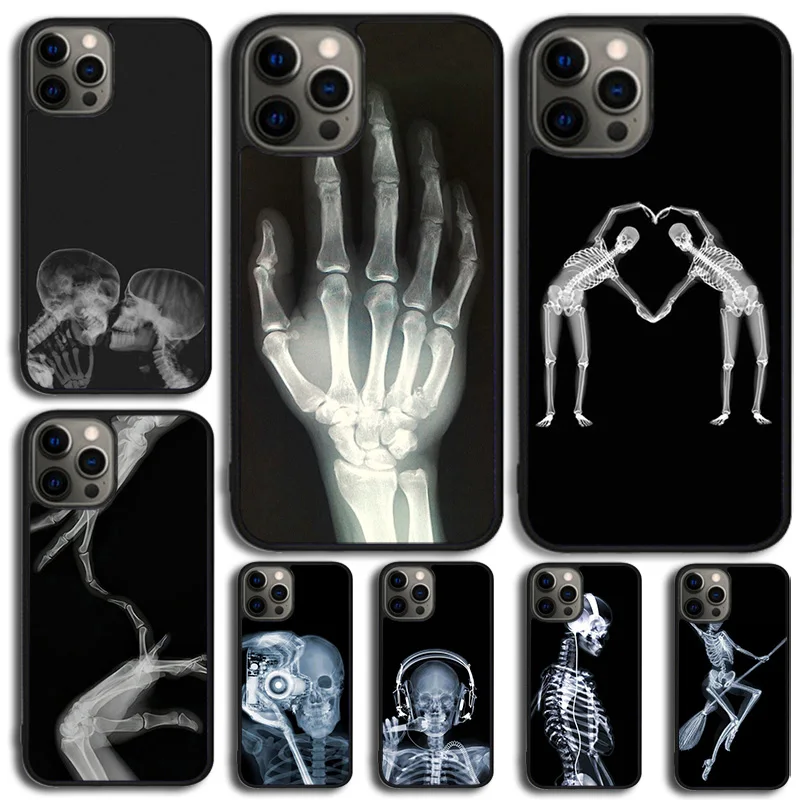Xray Art Aesthetic Skull Phone Case For Iphone 14 13 12 Mini Xr Xs Max
