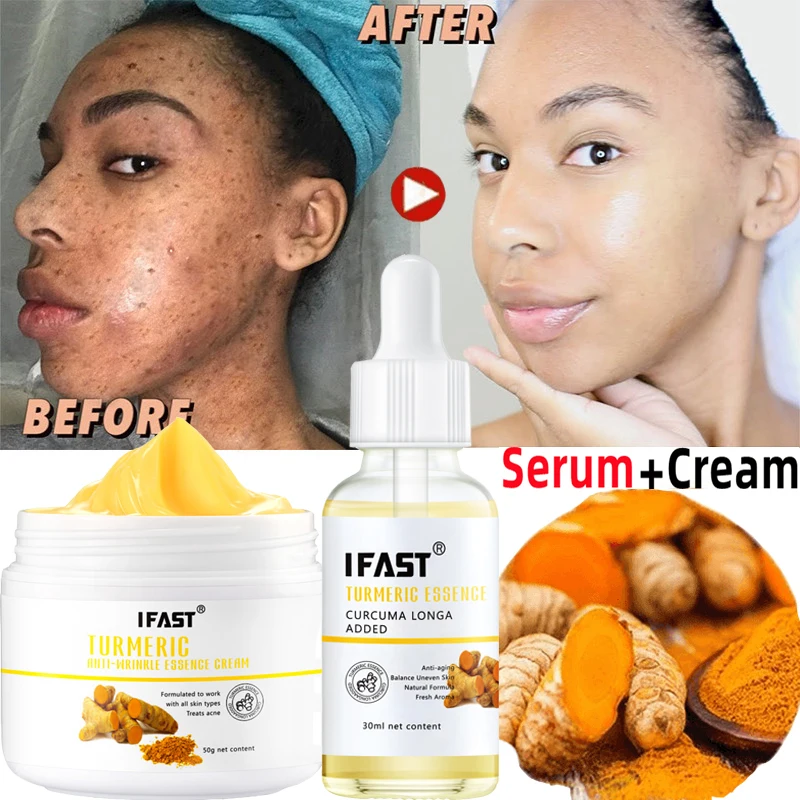 

Turmeric Whitening Freckles Serum Cream Remove Dark Spots Melasma Lighten Melanin Acne Scar Anti-aging Brighten Face Skin Care