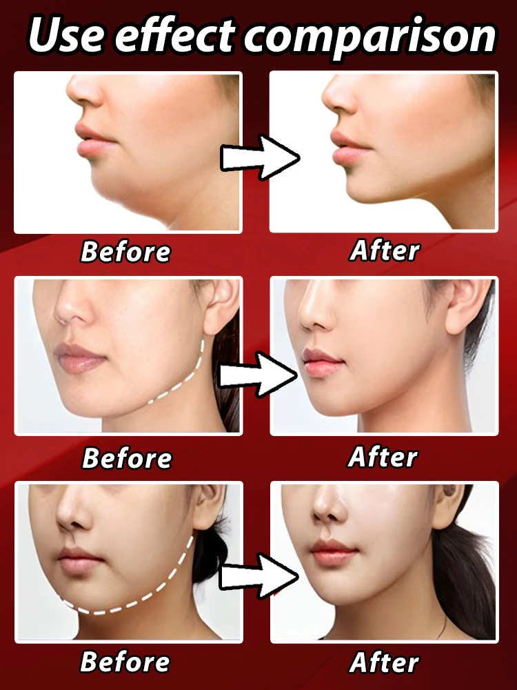 Face Lift Tape Double Chin Remove Face Slimming V Shape Firming lift