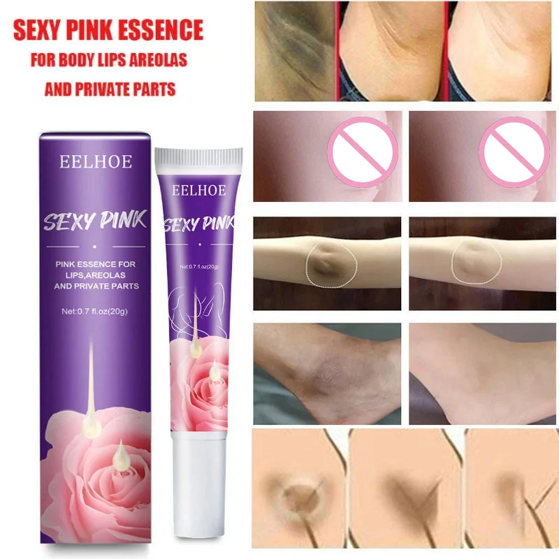Whitening Lotion Whitening Cream For Private Parts Arm Knees Lip