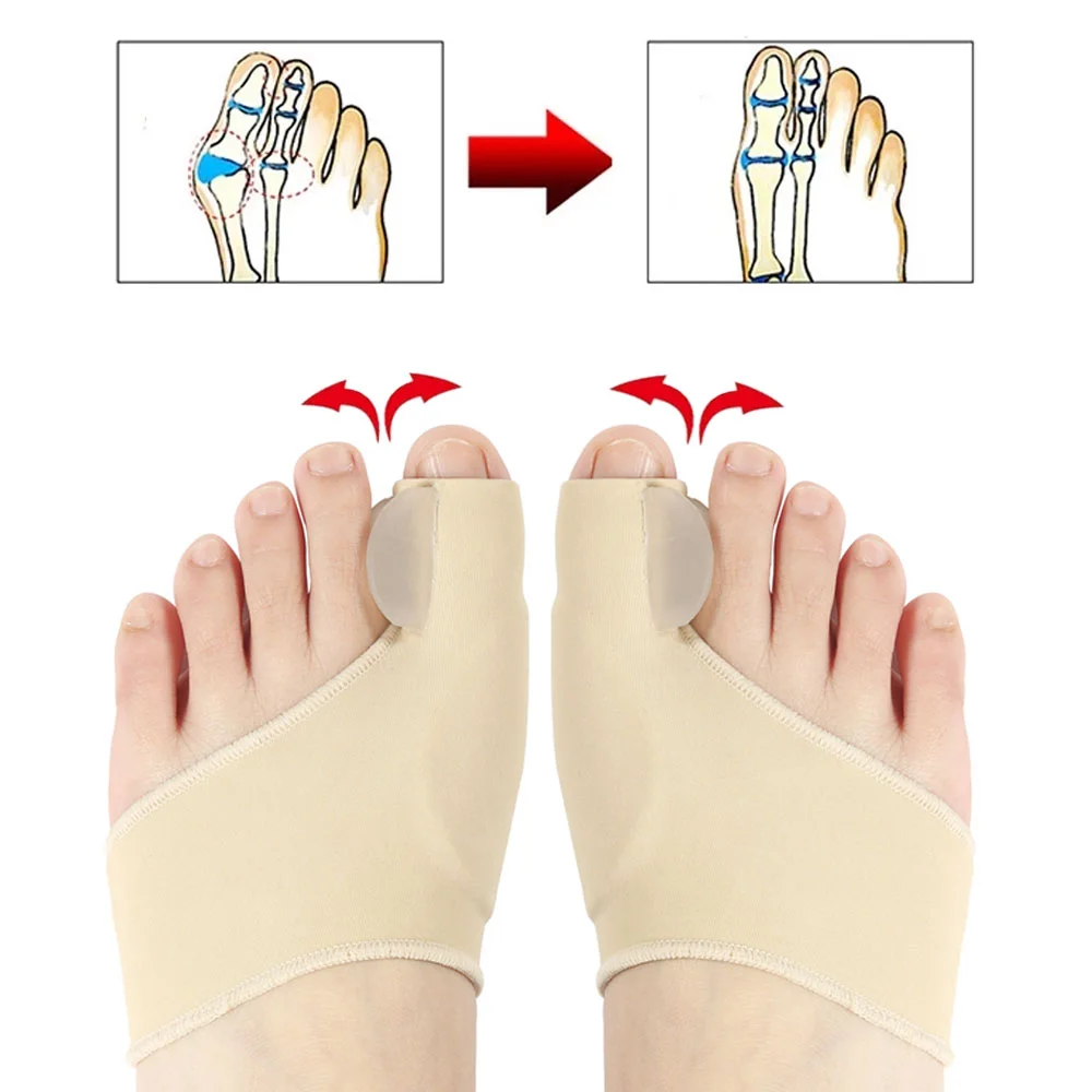 2 Stuks Teen Separator Hallux Valgus Bunion Corrector Orthesen Voeten Bot Duim Versteller Correctie Pedicure Sok Stijltang Gereedschap