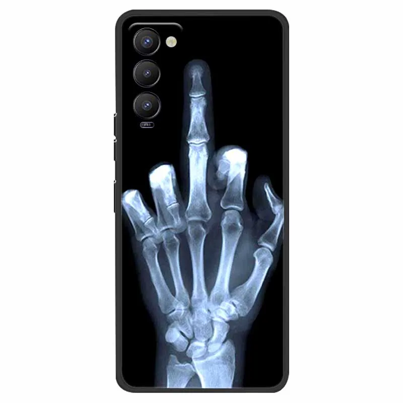 Fashion Soft TPU Silicone Phone Case - Stylish Back Cover