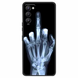 Cover posteriore in silicone TPU morbido per smartphone - Stile elegante