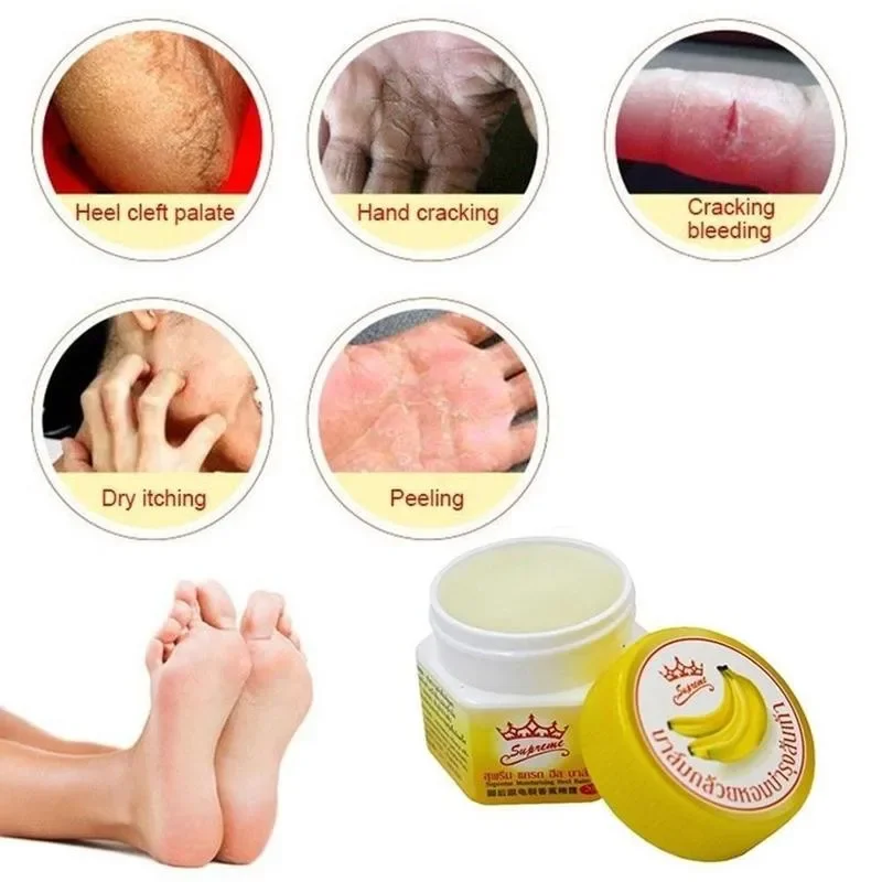 1pcs Thailand Banana Oil Blossoms Grass Repair Anti Dry Frozen Moisturizer Ointment Anti-cracking Cream Foot Hand Heel Skin Care