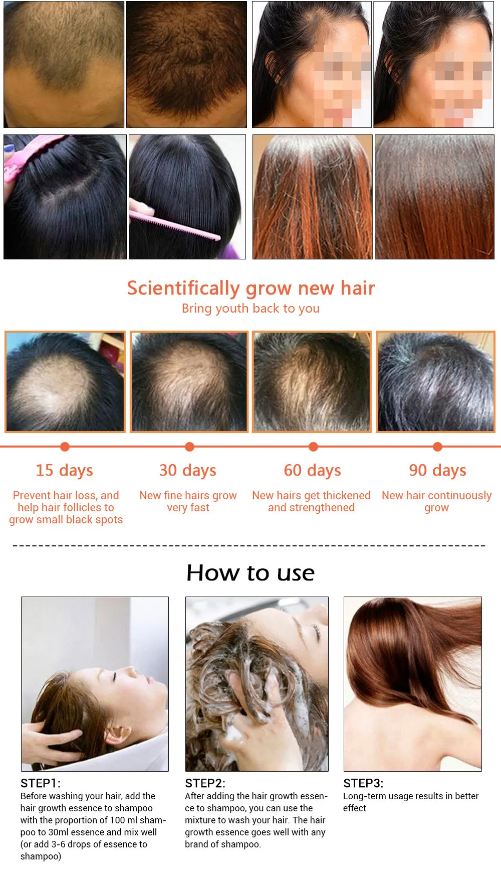 Extrato de Gengibre Crescimento do Cabelo Perda de Cabelo Cuidados com o Cabelo Andrea Cabelo Denso Rápido Sunburst Essência Restauração Líquido Soro Óleo 1 Pçs 20ml 4 Computers & Electronics