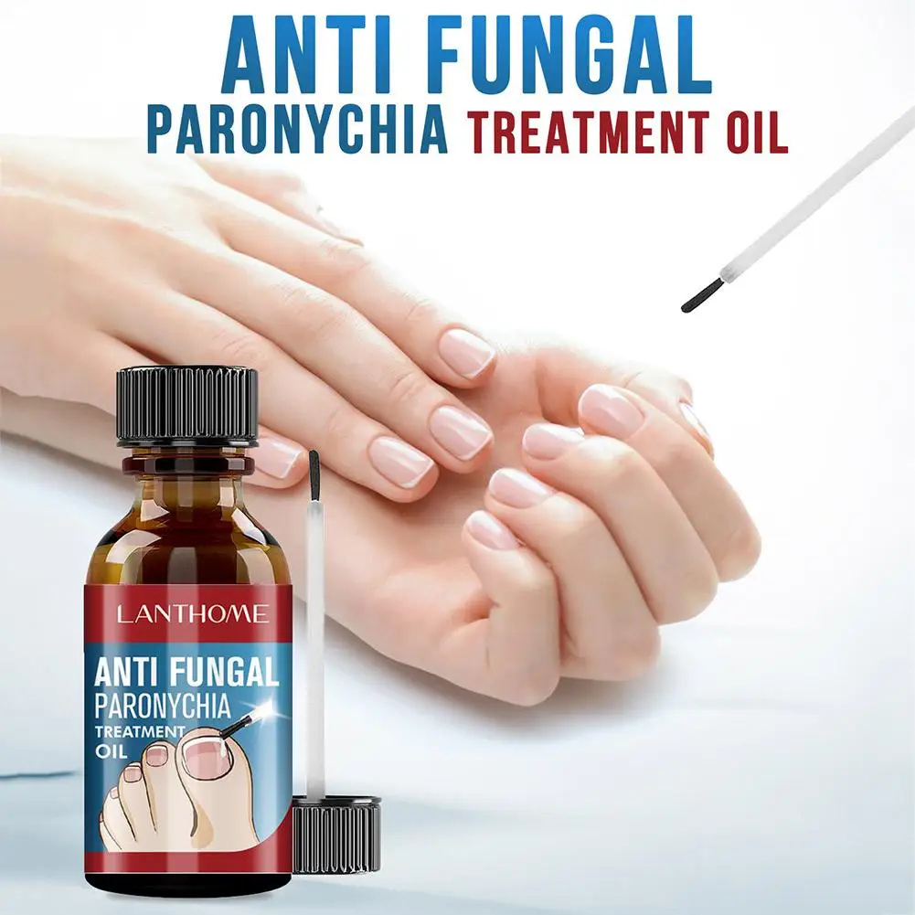 

10ml super strong nail fungus treatment essence care prevent repair damage putty fungus nail anti growth infection repair S8Q6